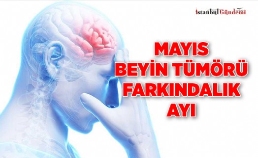 BEYİN TÜMÖRÜNDE EN SIK GÖRÜLEN 7 BELİRTİ