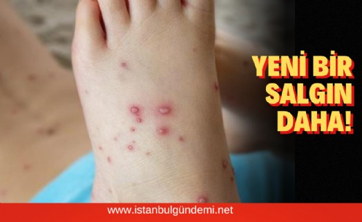 Domates gribi nedir?