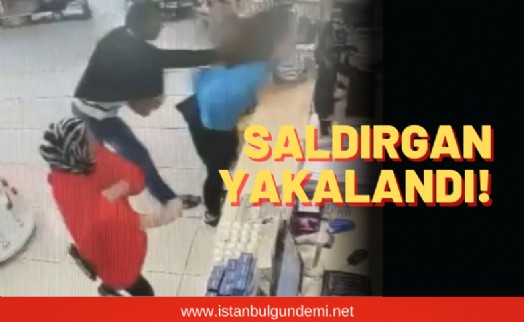 Genç kadın tanımadığı adam tarafından darp edilmişti…