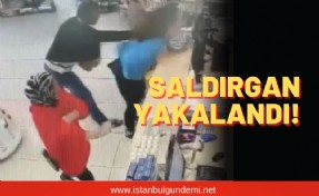 Genç kadın tanımadığı adam tarafından darp edilmişti…